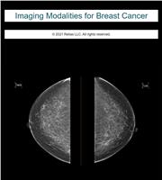 Imaging Modalities for Breast Cancer