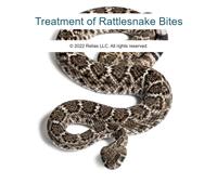 Treatment of Rattlesnake Bites