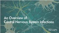 An Overview of Central Nervous System Infections