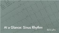 At a Glance: Sinus Rhythm