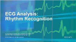 ECG Analysis: Rhythm Recognition