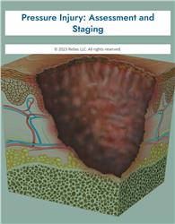 Pressure Injury: Assessment and Staging