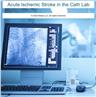 Acute Ischemic Stroke in the Cath Lab