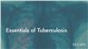 Essentials of Tuberculosis