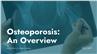 Osteoporosis: An Overview